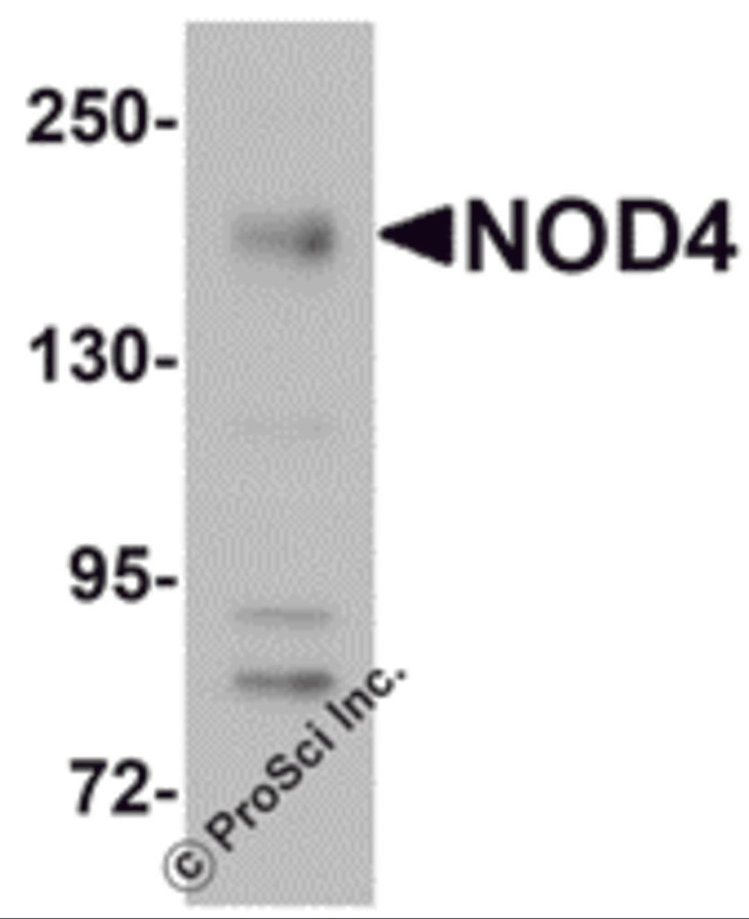Western blot analysis of NOD4 in EL4 cell lysate with NOD4 antibody at 1 μg/mL.