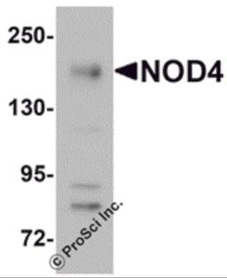 Western blot analysis of NOD4 in EL4 cell lysate with NOD4 antibody at 1 μg/mL.