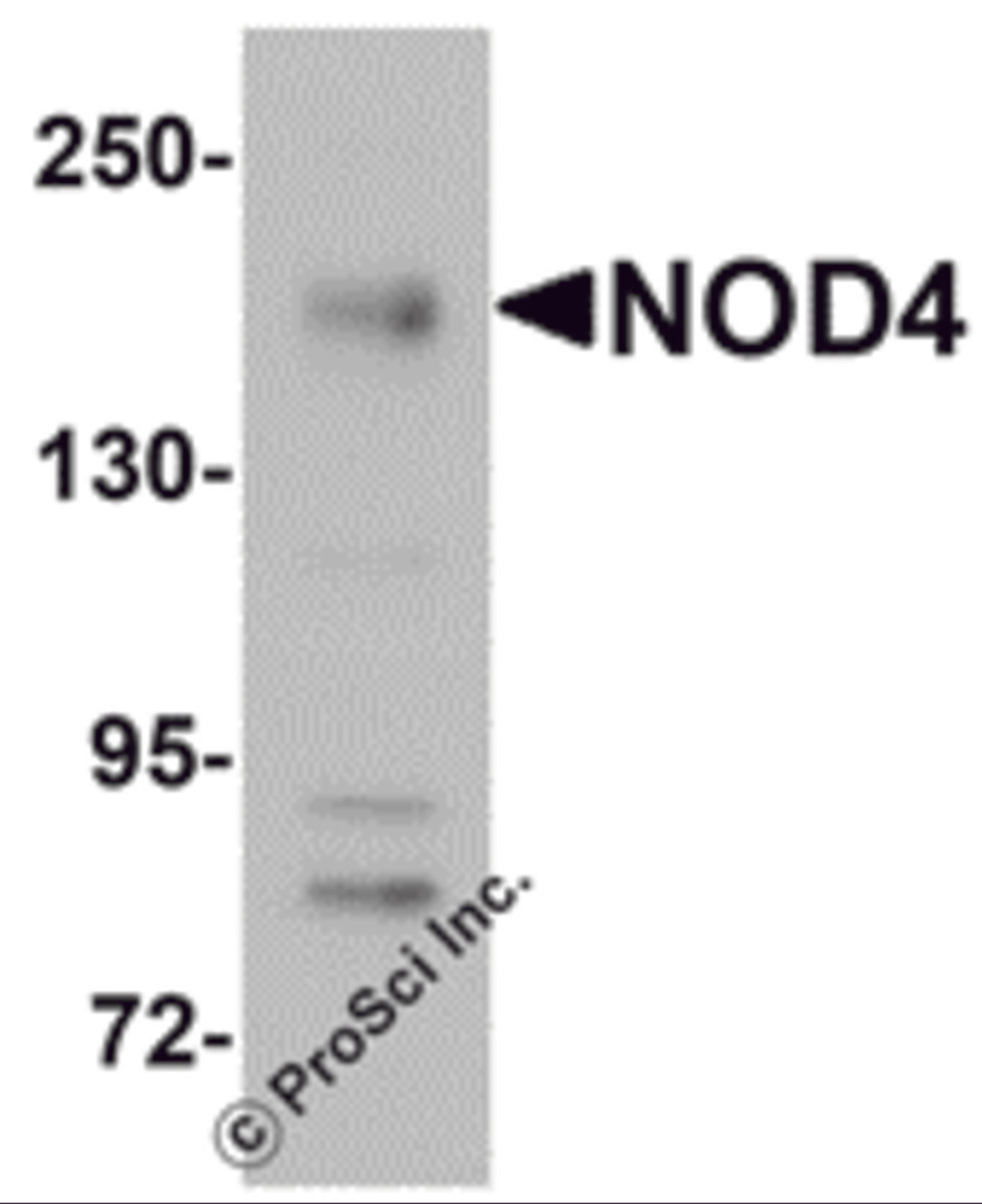 Western blot analysis of NOD4 in EL4 cell lysate with NOD4 antibody at 1 μg/mL.