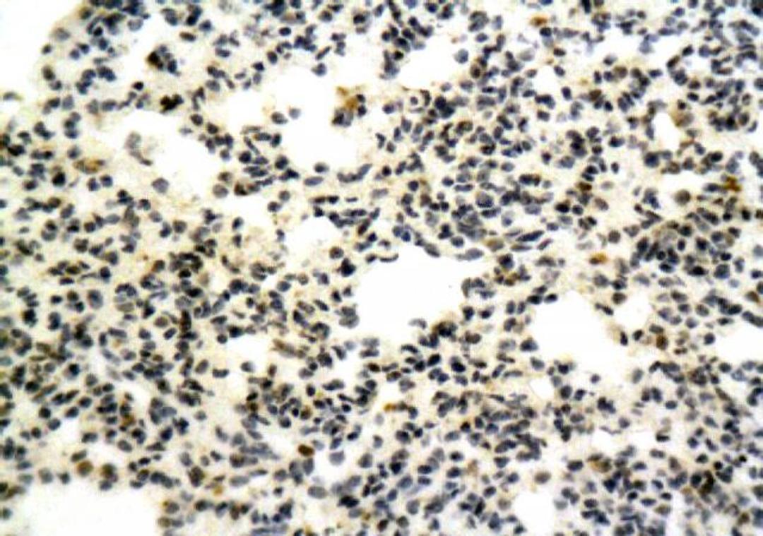 Immunohistochemical staining of paraffin embedded mouse lung tissue using NK1/Substance P Receptor antibody.