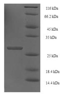 (Tris-Glycine gel) Discontinuous SDS-PAGE (reduced) with 5% enrichment gel and 15% separation gel.