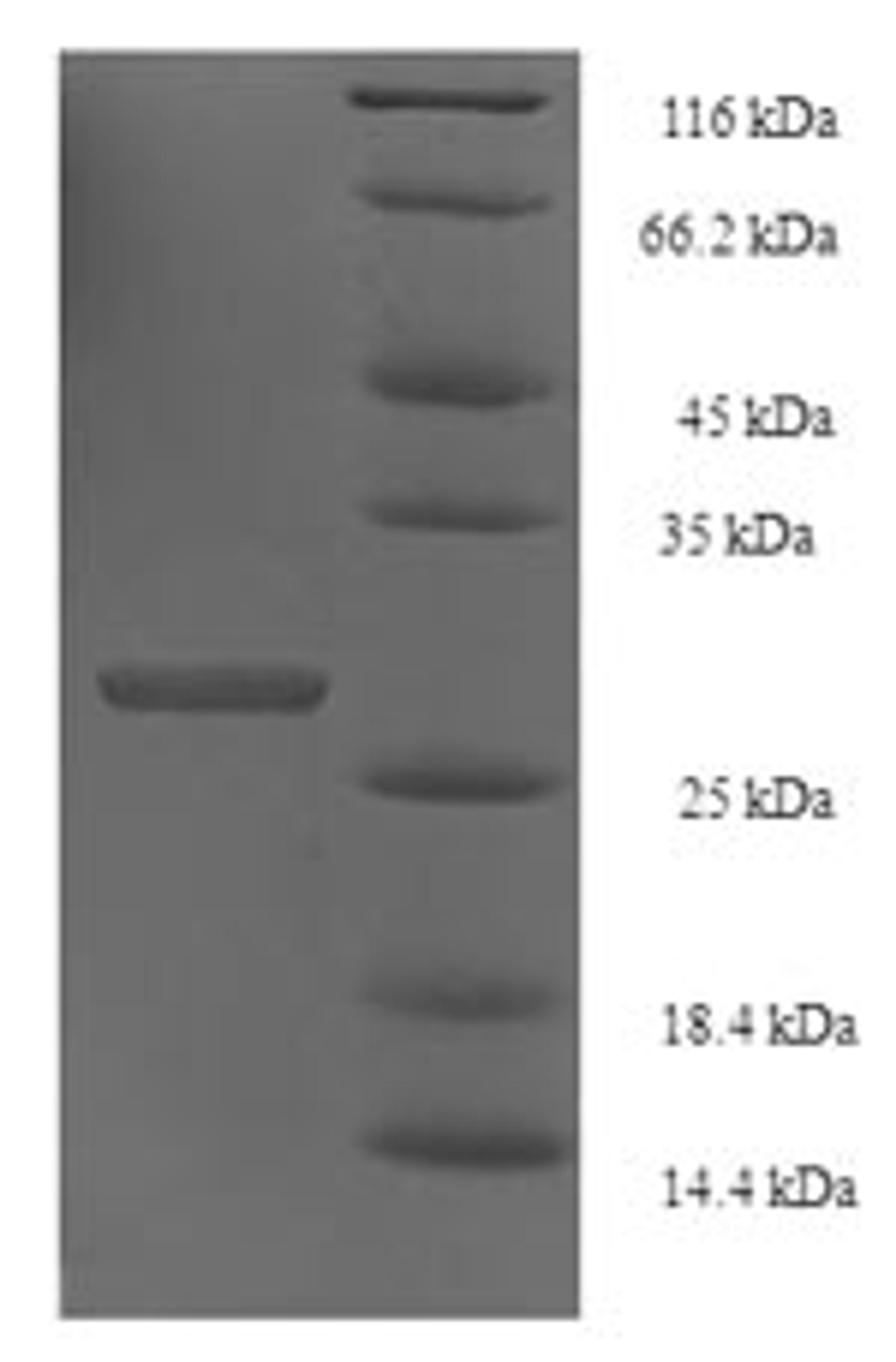 (Tris-Glycine gel) Discontinuous SDS-PAGE (reduced) with 5% enrichment gel and 15% separation gel.