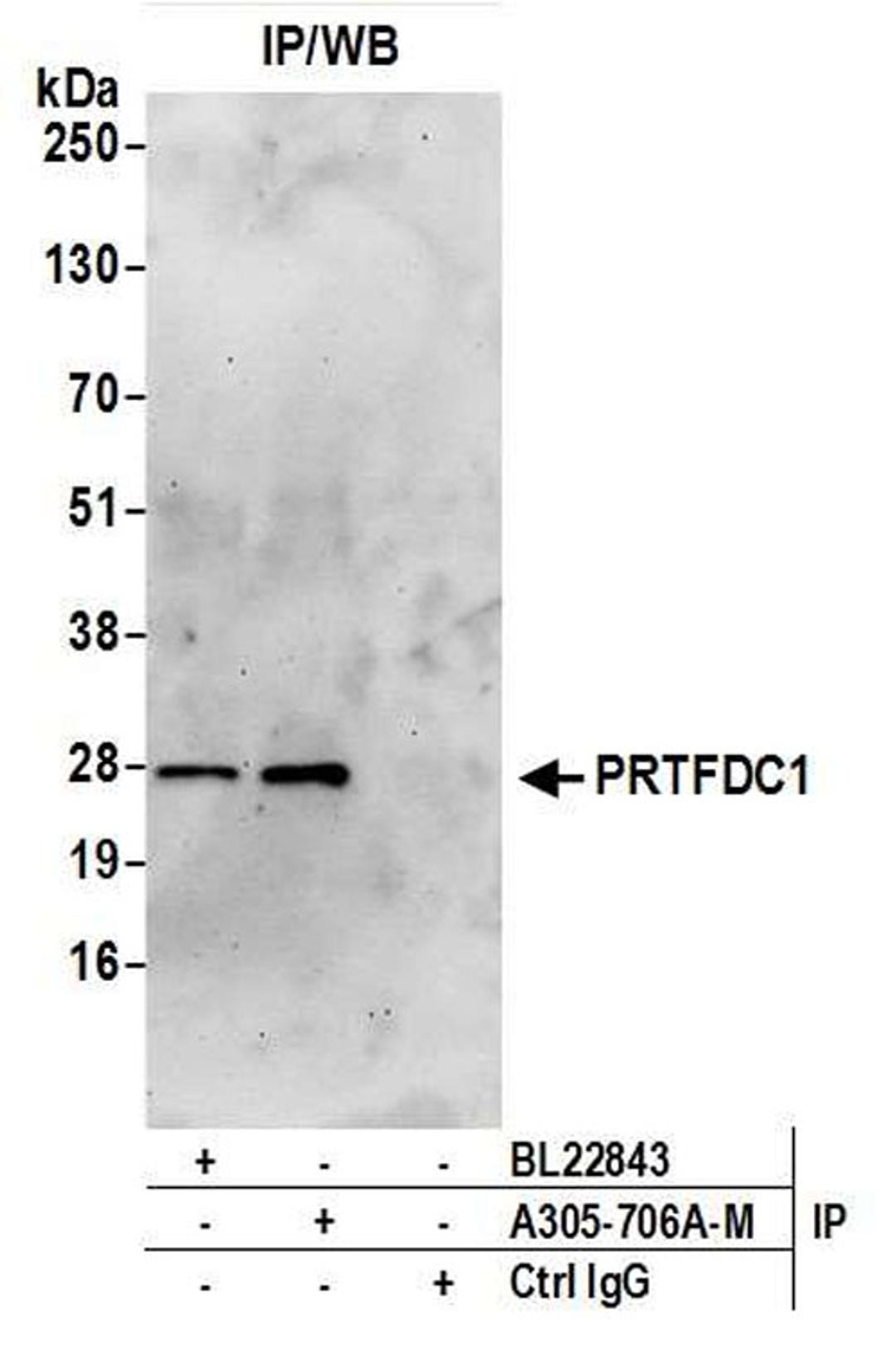 Detection of human PRTFDC1 by WB of IP.