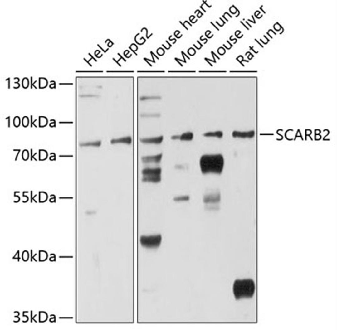 Western blot - SCARB2 antibody (A12723)