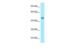 Antibody used in WB on Human Placenta at 1 ug/ml.