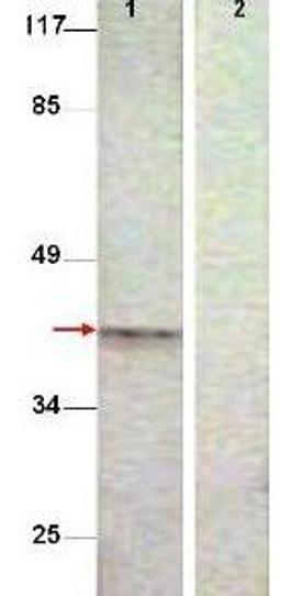 Western blot analysis of Extract from COS7 cells treated with Nocodazole (1ug/ml, 16 hrs) (Lane1), Extract from COS7 cells treated with Nocodazole (1ug/ml, 16 hrs) (Lane2) using Aurora B (phospho-pT232) antibody