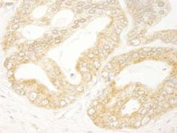 Detection of human eIF4H by immunohistochemistry.