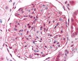 Immunohistochemistry staining of ST7 in kidney (formalin-fixed paraffin embedded) tissue using ST7 Antibody.