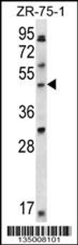 Western blot analysis in ZR-75-1 cell line lysates (35ug/lane).