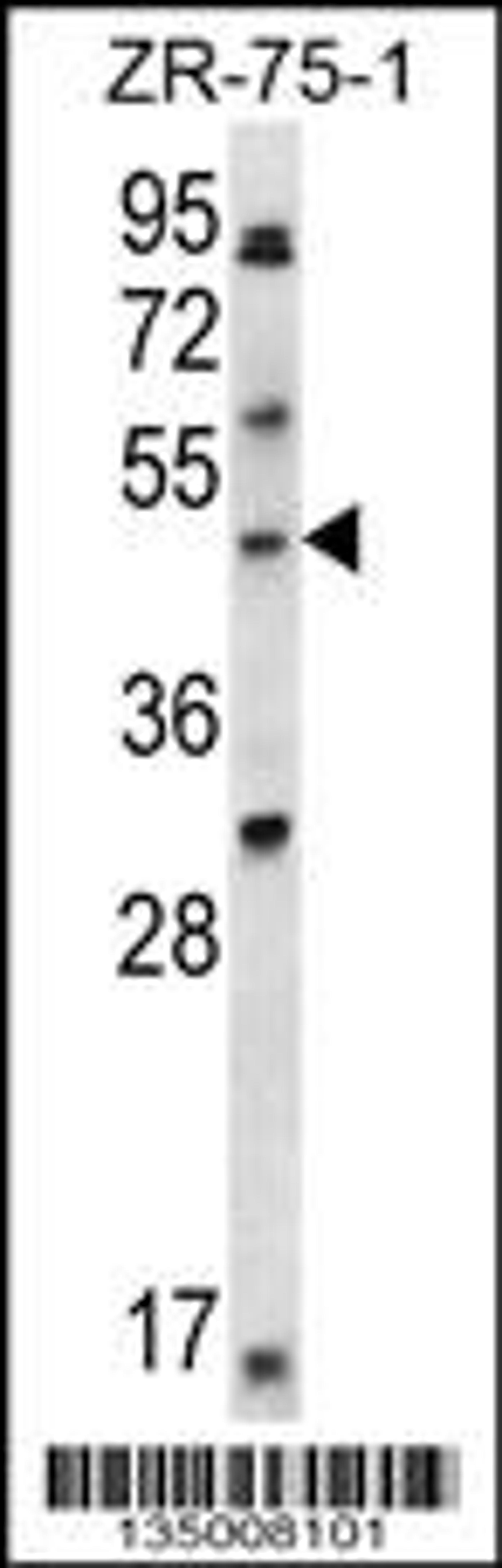 Western blot analysis in ZR-75-1 cell line lysates (35ug/lane).