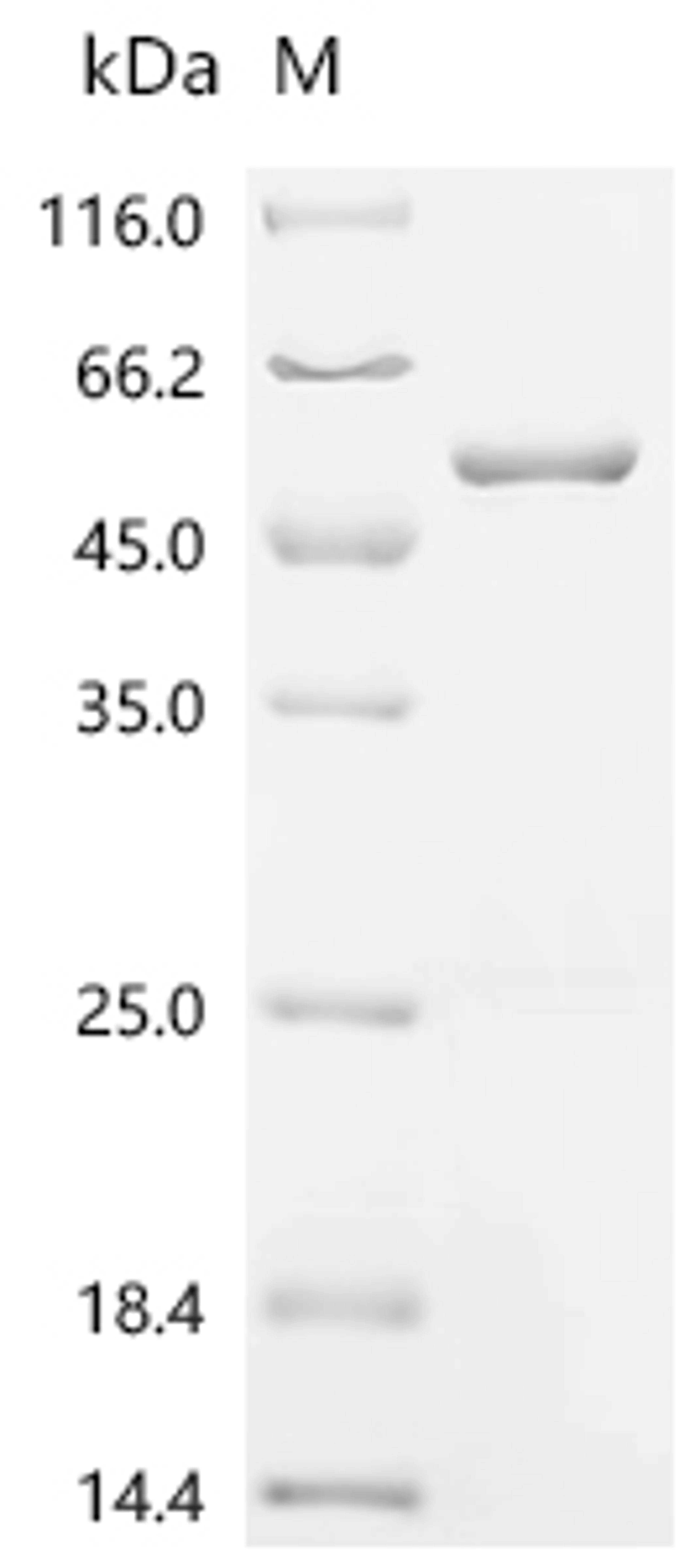 (Tris-Glycine gel) Discontinuous SDS-PAGE (reduced) with 5% enrichment gel and 15% separation gel.