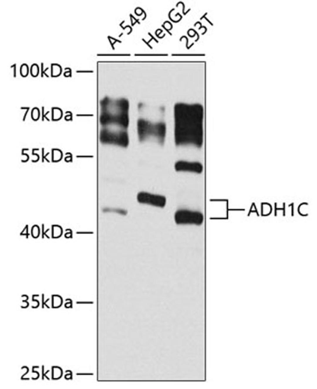 Western blot - ADH1C antibody (A8081)