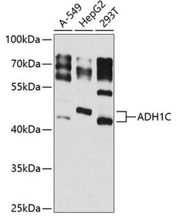 Western blot - ADH1C antibody (A8081)