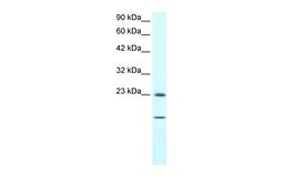 Antibody used in WB on Human HepG2 at 1 ug/ml.