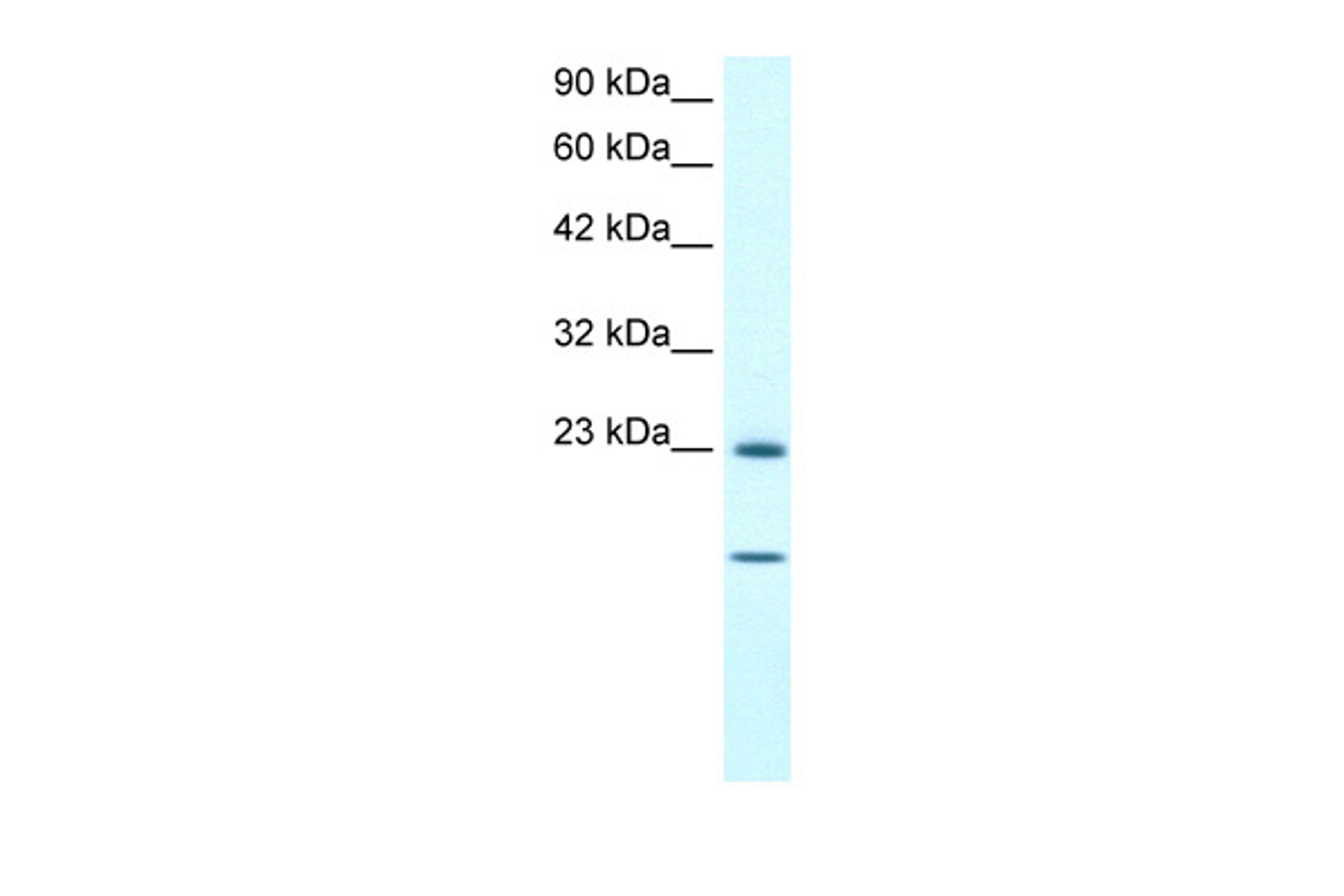 Antibody used in WB on Human HepG2 at 1 ug/ml.