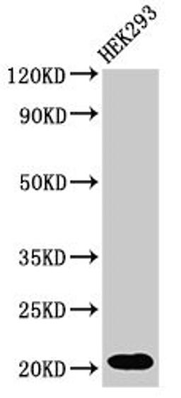 Western Blot. Positive WB detected in: HEK293 whole cell lysate. All lanes: RPS10P5 antibody at 2µg/ml. Secondary. Goat polyclonal to rabbit IgG at 1/50000 dilution. Predicted band size: 21 kDa. Observed band size: 21 kDa
