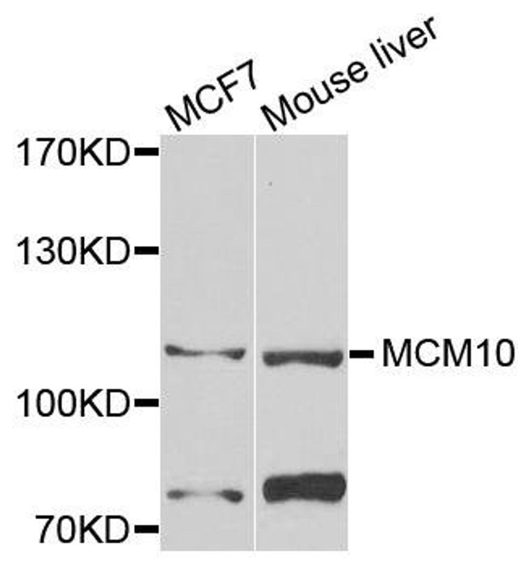 Western blot analysis of extracts of various cell lines using MCM10 antibody