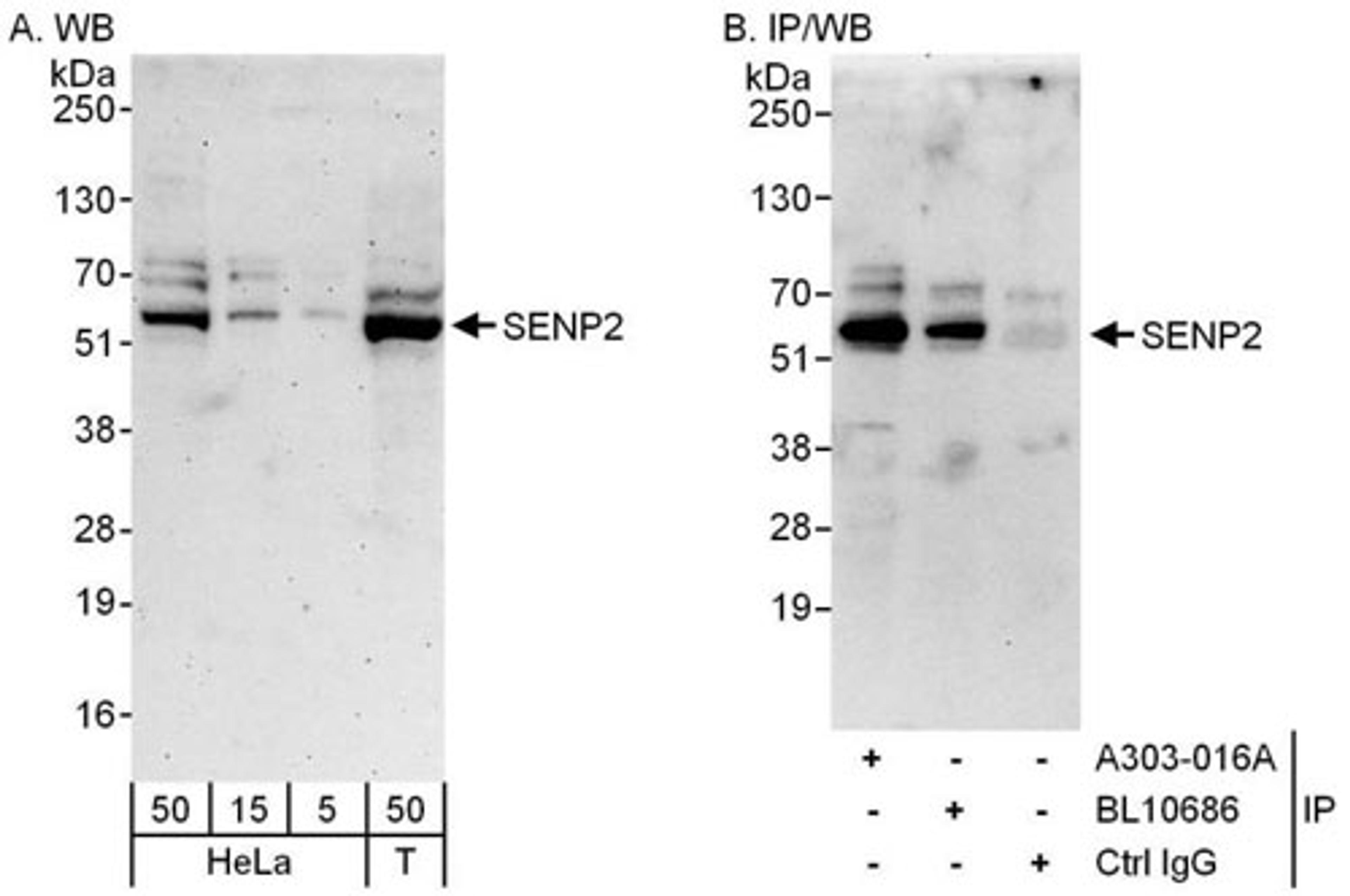 Detection of human SENP2 by WB and IP.