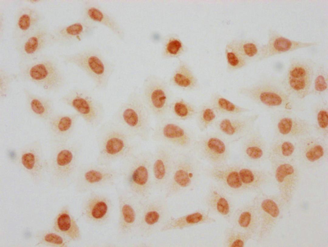 Immunocytochemistry analysis of CSB-PA010389OA119crHU diluted at 1:100 and staining in Hela cells(treated with 30mM sodium crotonylate for 4h) performed on a Leica BondTM system. The cells were fixed in 4% formaldehyde, permeabilized using 0.2% Triton X-100 and blocked with 10% normal goat serum 30min at RT. Then primary antibody (1% BSA) was incubated at 4°C overnight. The primary is detected by a biotinylated secondary antibody and visualized using an HRP conjugated SP system.