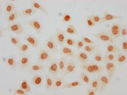 Immunocytochemistry analysis of CSB-PA010389OA119crHU diluted at 1:100 and staining in Hela cells(treated with 30mM sodium crotonylate for 4h) performed on a Leica BondTM system. The cells were fixed in 4% formaldehyde, permeabilized using 0.2% Triton X-100 and blocked with 10% normal goat serum 30min at RT. Then primary antibody (1% BSA) was incubated at 4°C overnight. The primary is detected by a biotinylated secondary antibody and visualized using an HRP conjugated SP system.