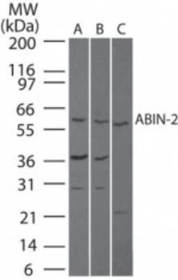 Western Blot: TNIP2 Antibody [NB100-56701] - Analysis of TNIP2 in A) human brain, B) mouse brain and C) rat brain lysate using this antibody at 3 ug/ml.