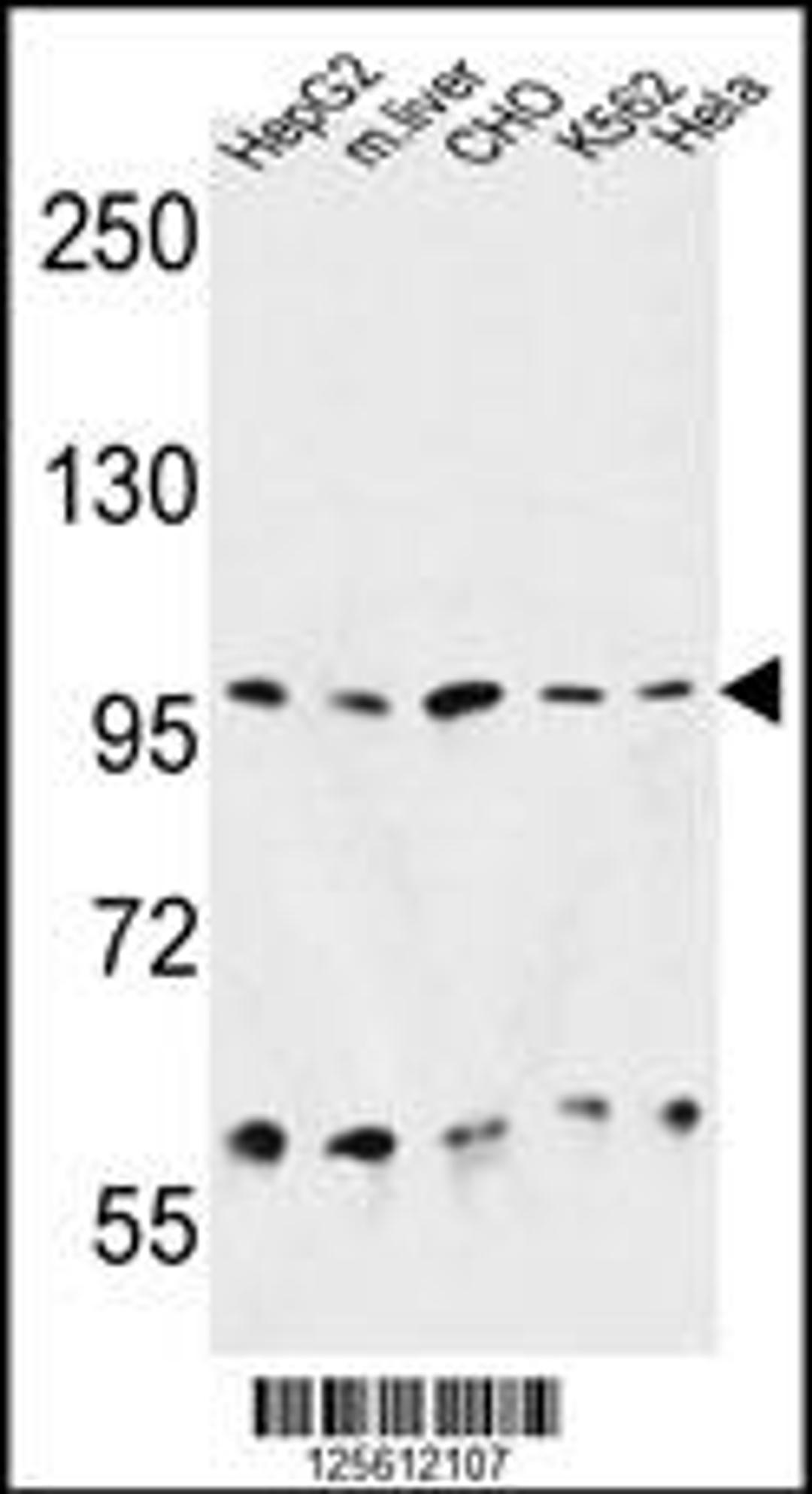 Western blot analysis in HepG2, CHO, K562, Hela cell line and mouse liver tissue lysates (35ug/lane).