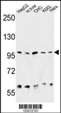 Western blot analysis in HepG2, CHO, K562, Hela cell line and mouse liver tissue lysates (35ug/lane).