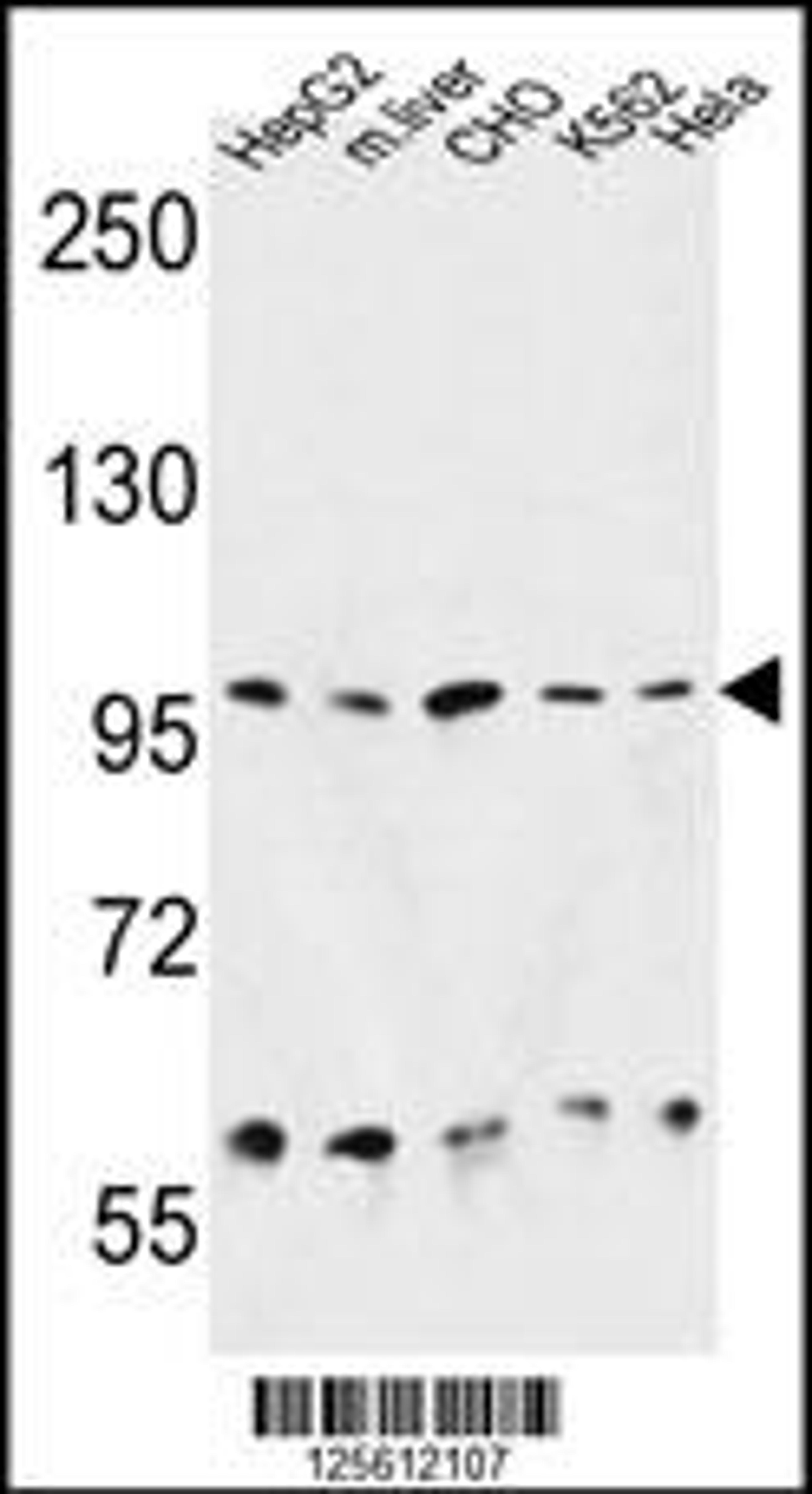 Western blot analysis in HepG2, CHO, K562, Hela cell line and mouse liver tissue lysates (35ug/lane).