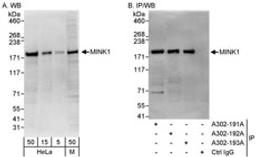 Detection of human and mouse MINK1 by western blot (h&m) and immunoprecipitation (h).