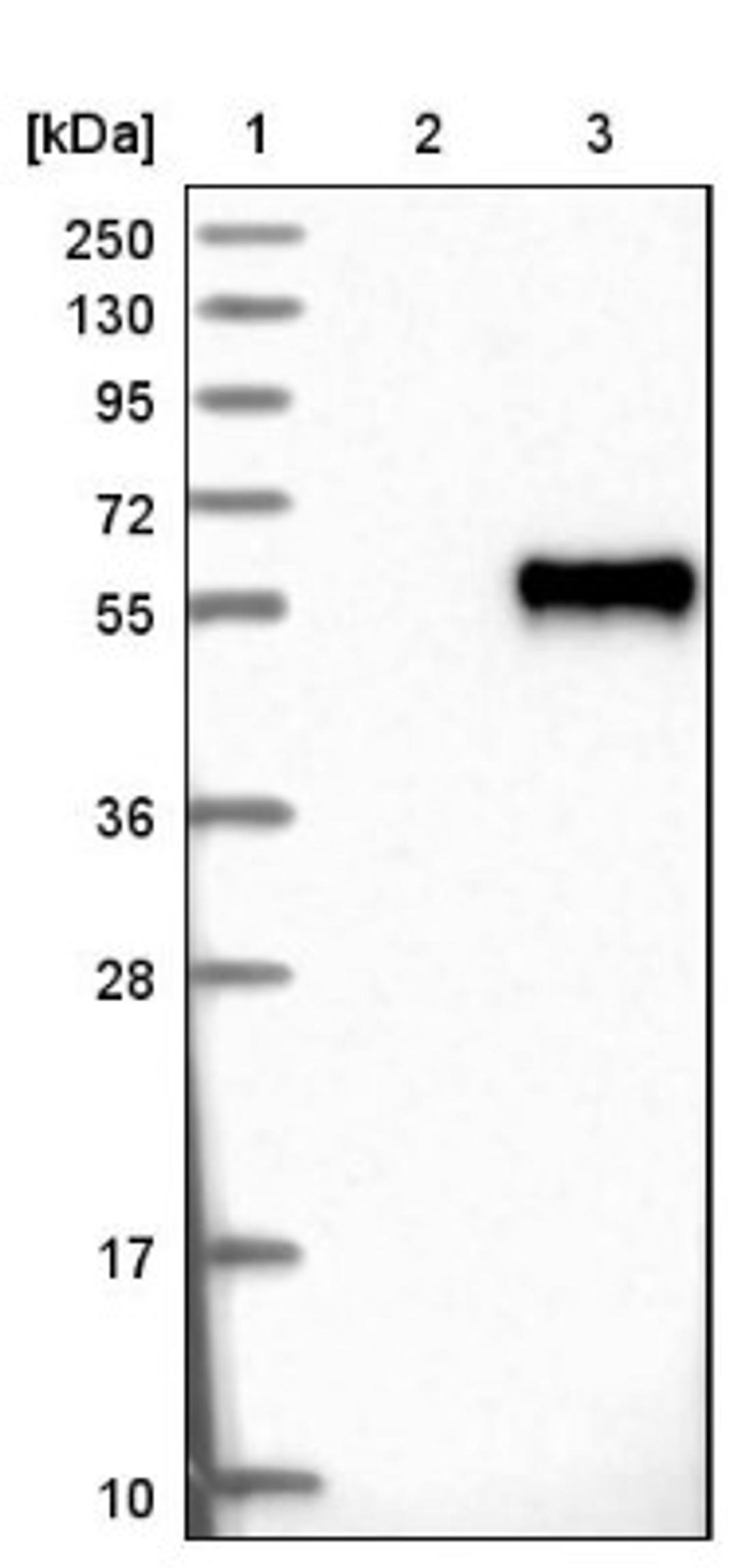 Western Blot: OSTM1 Antibody [NBP1-81829] - Lane 1: Marker [kDa] 250, 130, 95, 72, 55, 36, 28, 17, 10<br/>Lane 2: Negative control (vector only transfected HEK293T lysate)<br/>Lane 3: Over-expression lysate (Co-expressed with a C-terminal myc-DDK tag (~3.1 kDa) in mammalian HEK293T cells, LY402271)