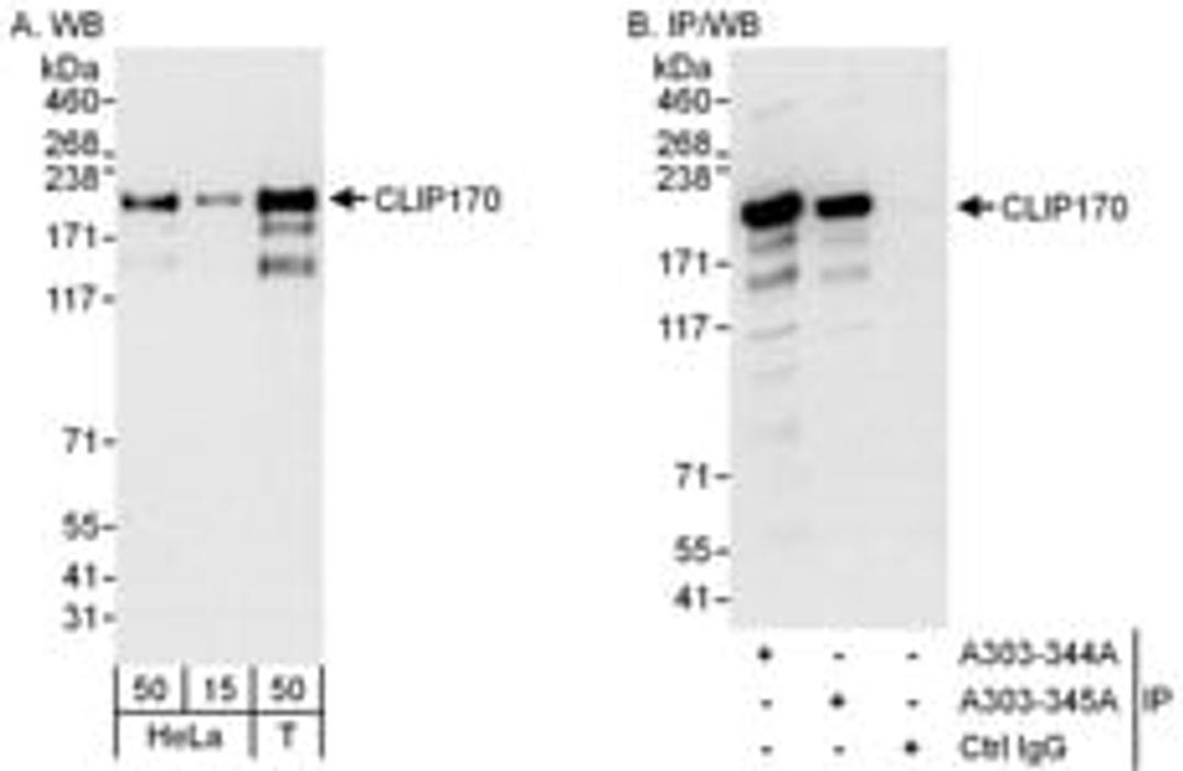 Detection of human CLIP170 by western blot and immunoprecipitation.