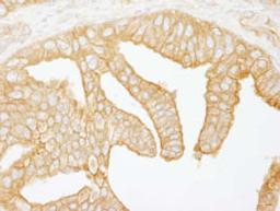 Detection of human Filamin B by immunohistochemistry.