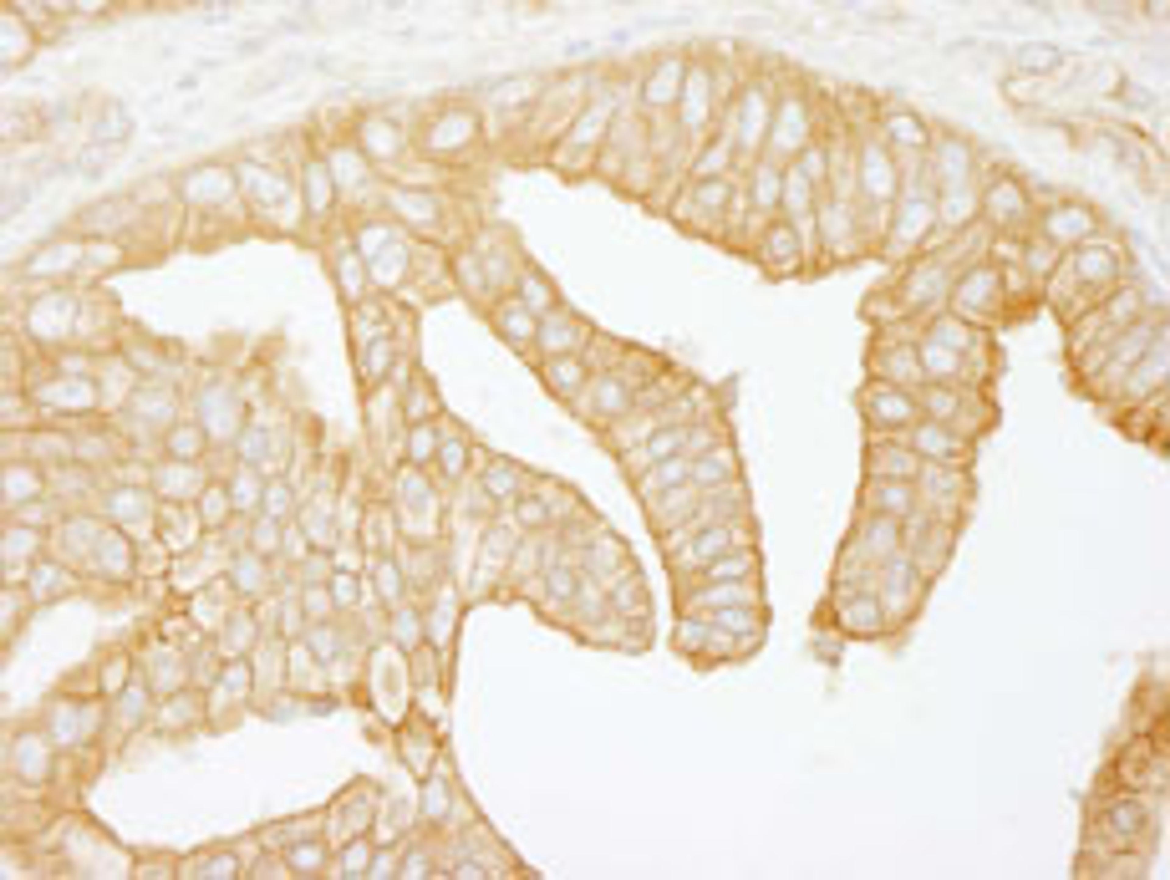 Detection of human Filamin B by immunohistochemistry.