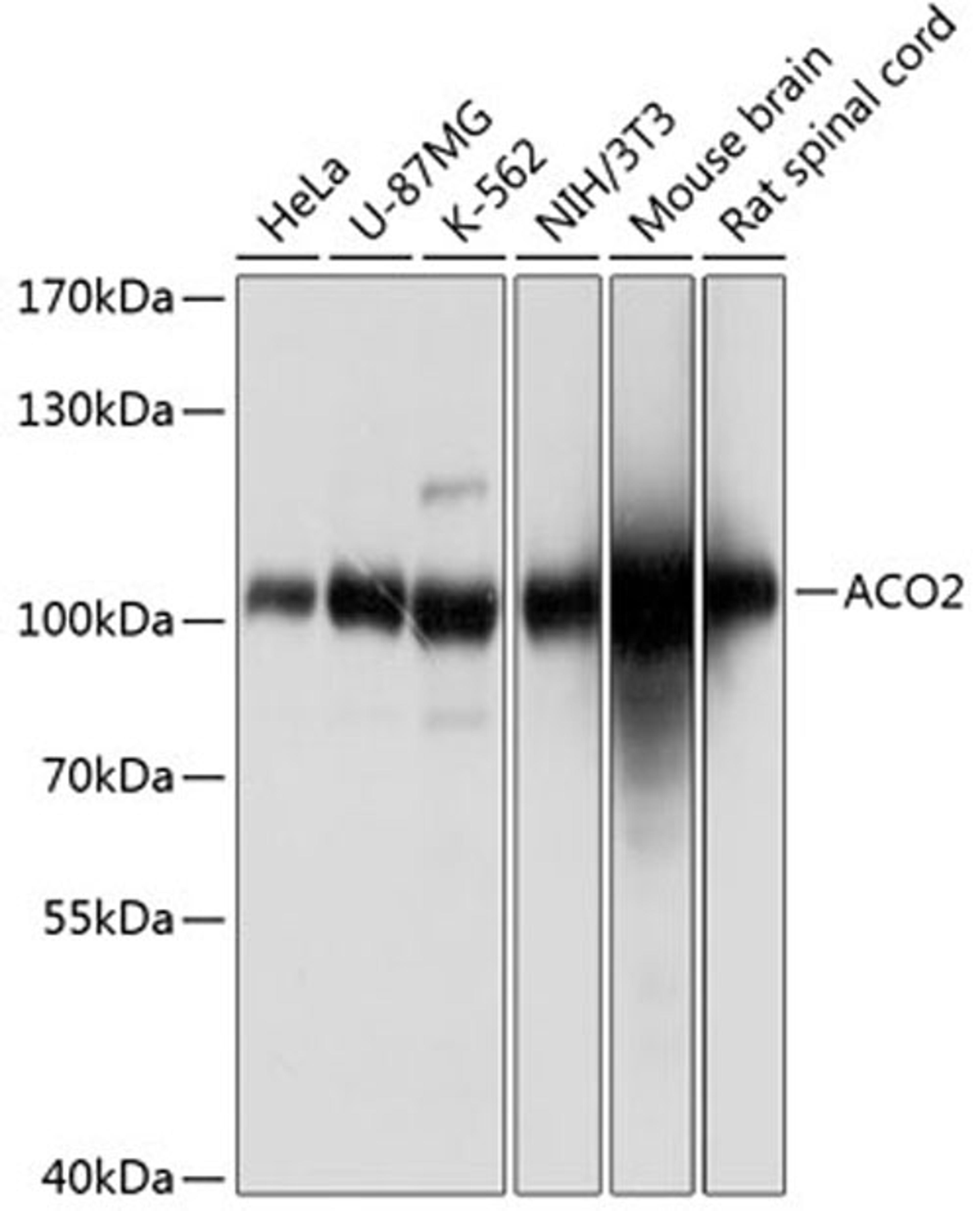 Western blot - ACO2 antibody (A3716)
