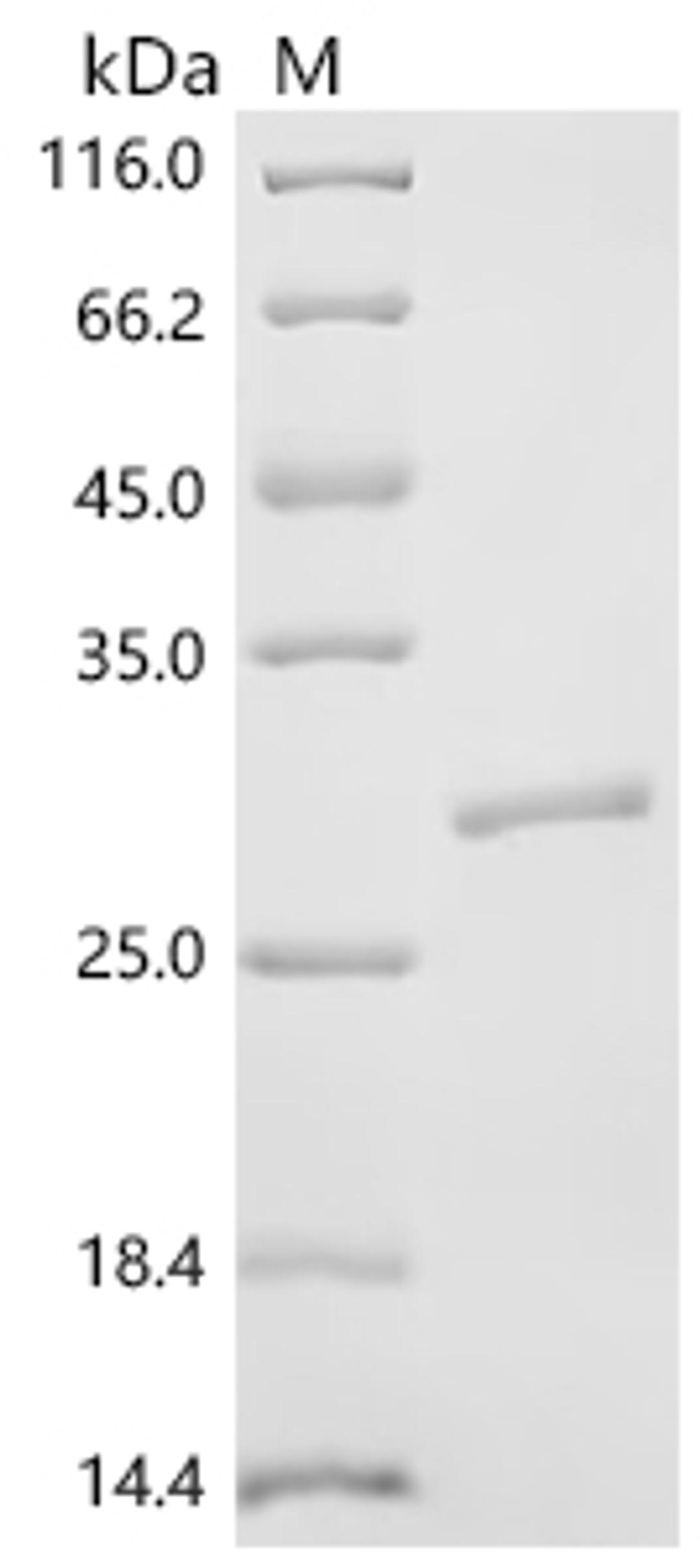 (Tris-Glycine gel) Discontinuous SDS-PAGE (reduced) with 5% enrichment gel and 15% separation gel.