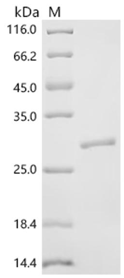 (Tris-Glycine gel) Discontinuous SDS-PAGE (reduced) with 5% enrichment gel and 15% separation gel.