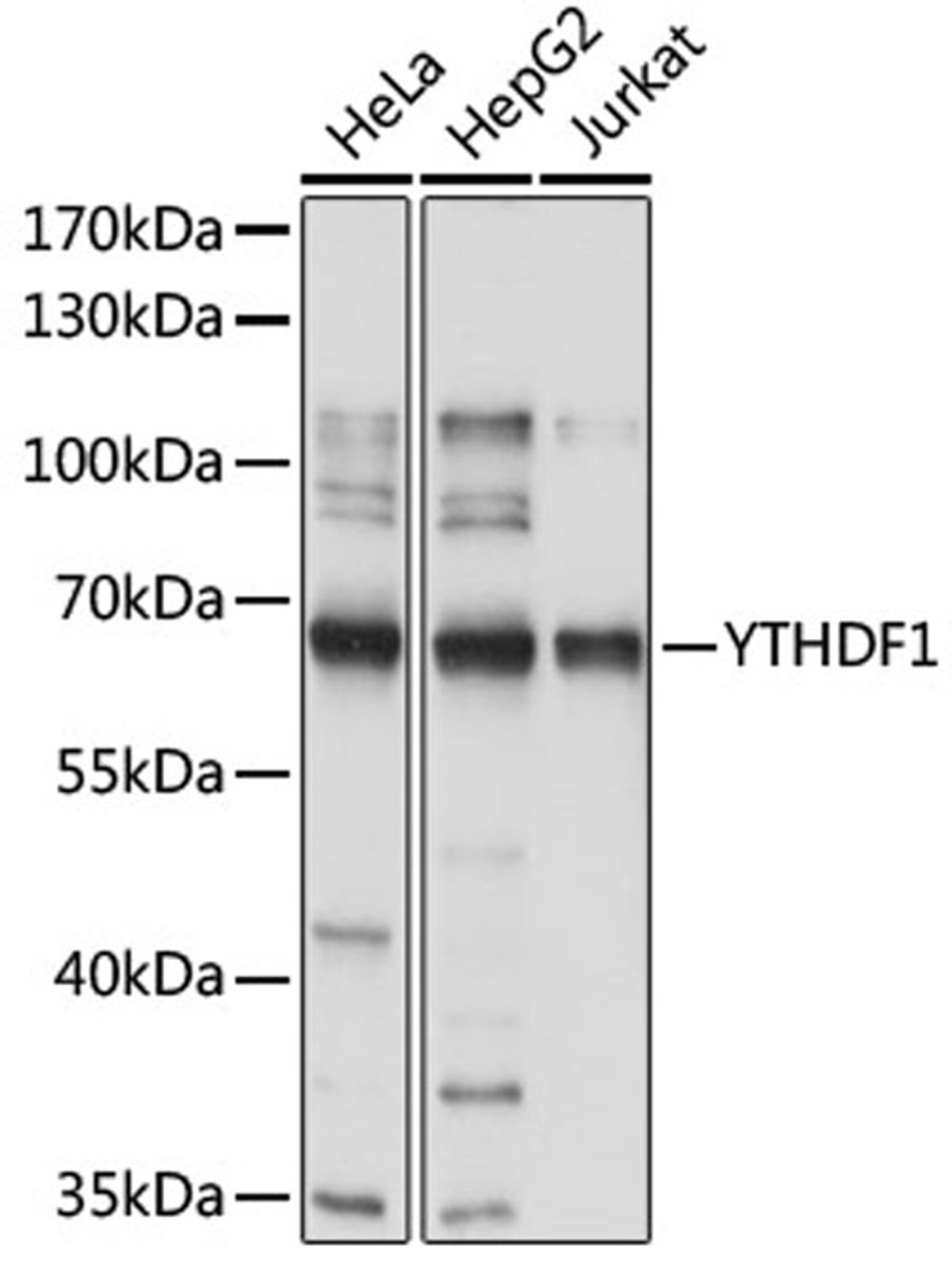 Western blot - YTHDF1 antibody (A18126)