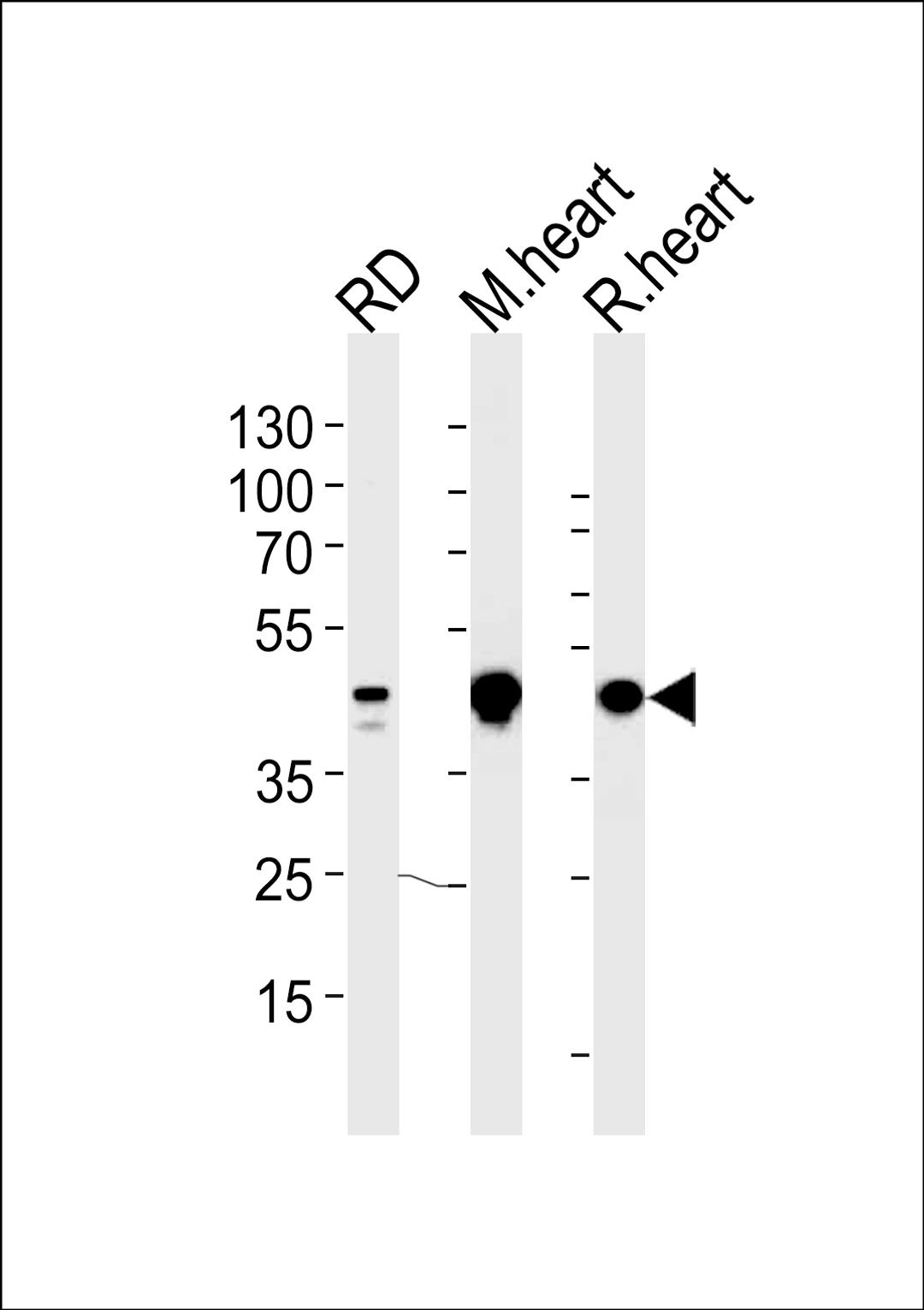 Western blot analysis in RD cell line and mouse heart,rat heart lysates (35ug/lane).