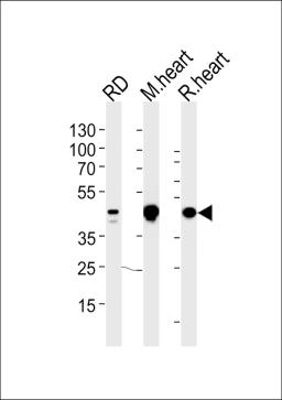 Western blot analysis in RD cell line and mouse heart,rat heart lysates (35ug/lane).