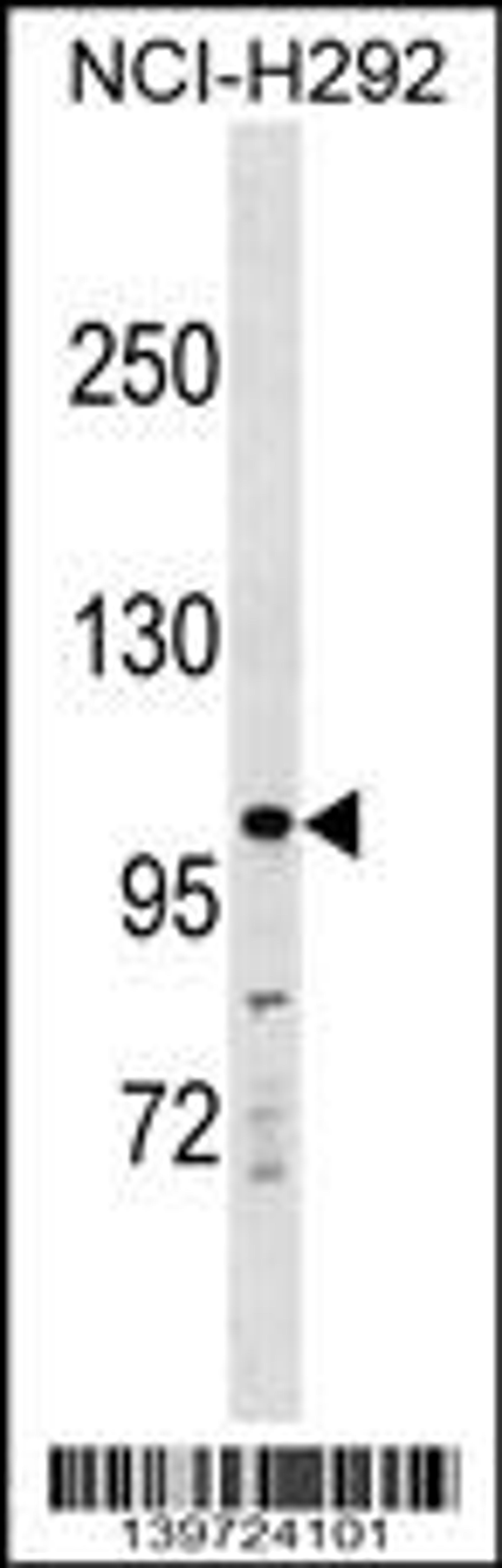 Western blot analysis in NCI-H292 cell line lysates (35ug/lane).This demonstrates the KIT antibody detected the KIT protein (arrow).