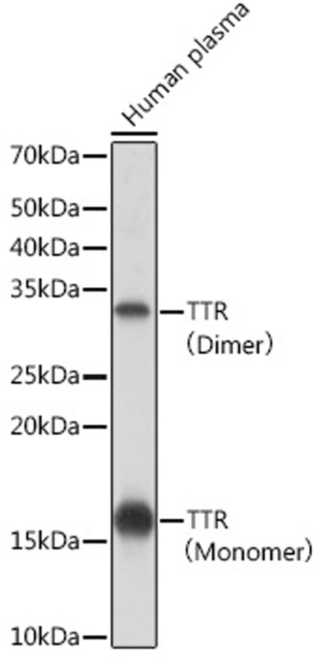 Western blot - TTR Rabbit mAb (A4067)