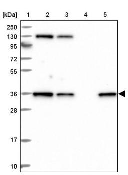 Western Blot: DCUN1D3 Antibody [NBP2-47495] - Lane 1: Marker [kDa] 250, 130, 95, 72, 55, 36, 28, 17, 10.  Lane 2: Human cell line RT-4.  Lane 3: Human cell line U-251MG.  Lane 4: Human plasma (IgG/HSA depleted).  Lane 5: Human liver tissue.