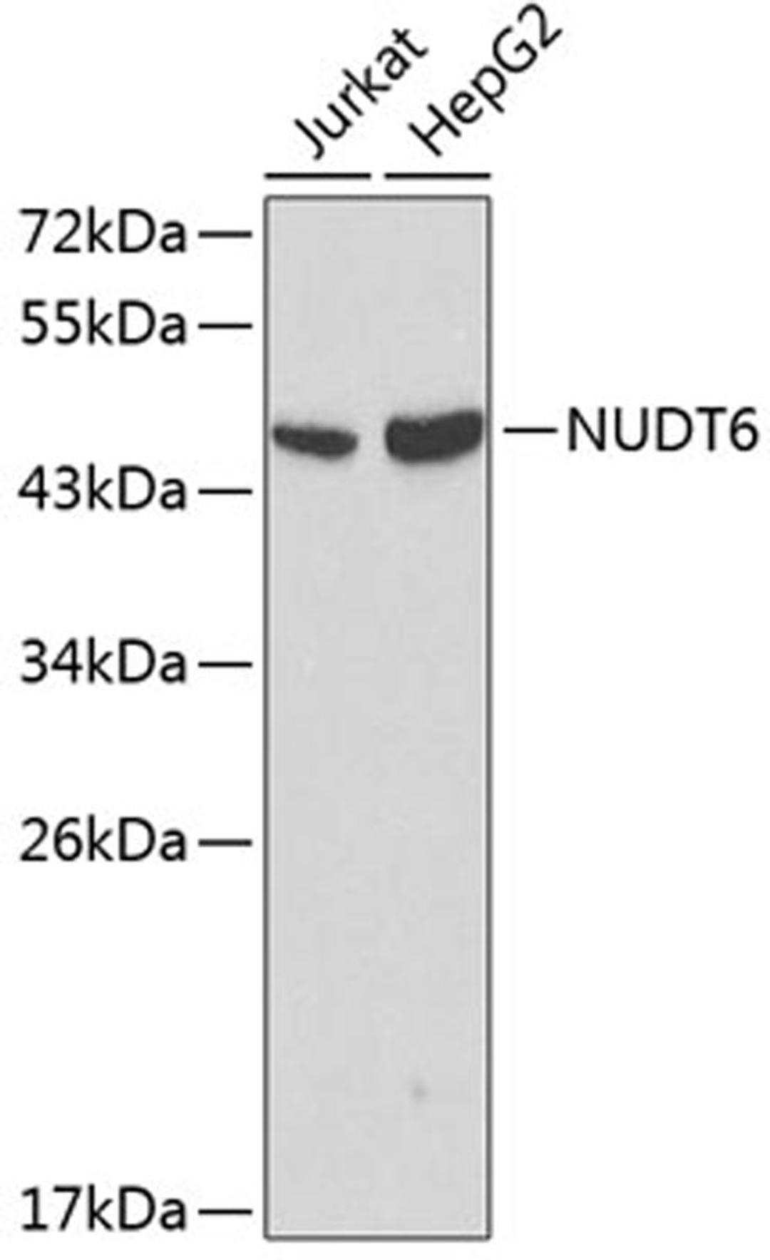 Western blot - NUDT6 antibody (A0260)