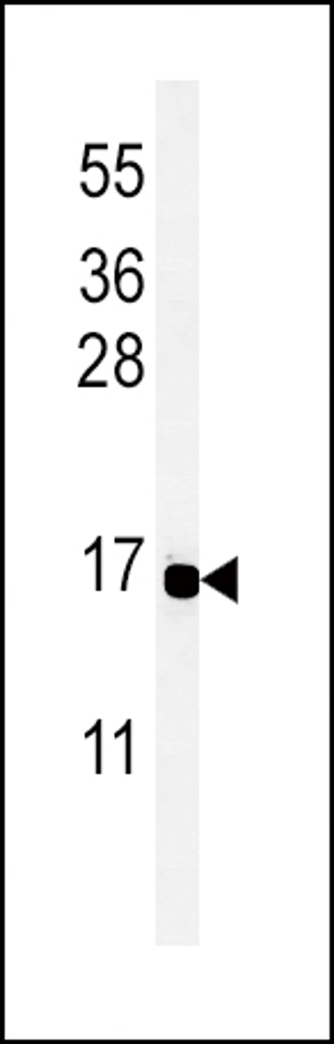 Western blot analysis of PYY Antibody in MCF-7 cell line lysates (35ug/lane)