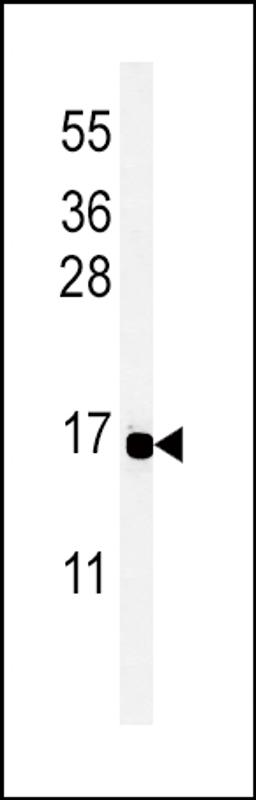 Western blot analysis of PYY Antibody in MCF-7 cell line lysates (35ug/lane)