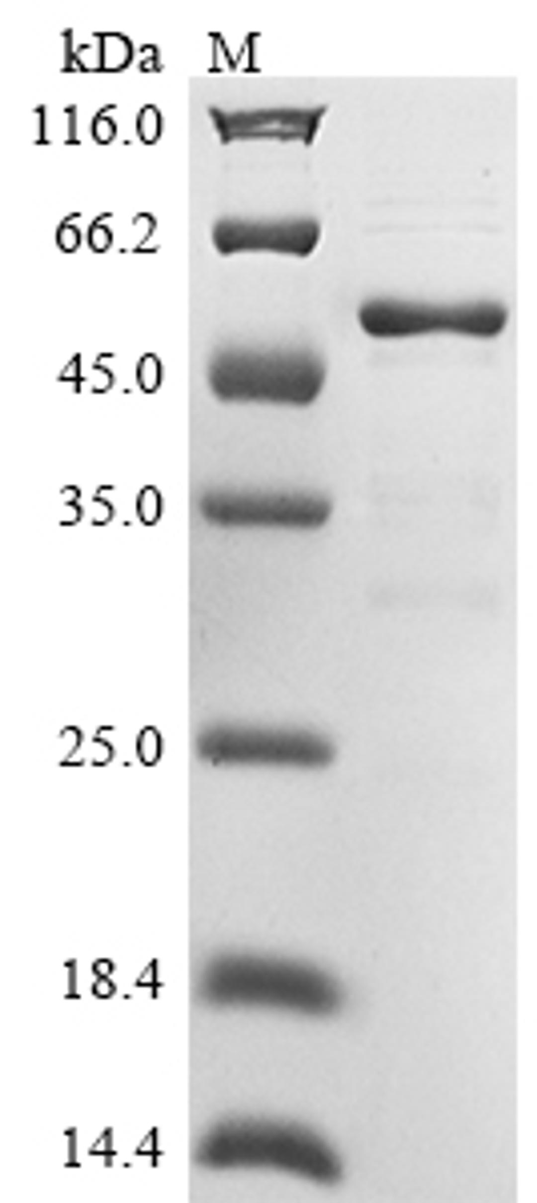 (Tris-Glycine gel) Discontinuous SDS-PAGE (reduced) with 5% enrichment gel and 15% separation gel.