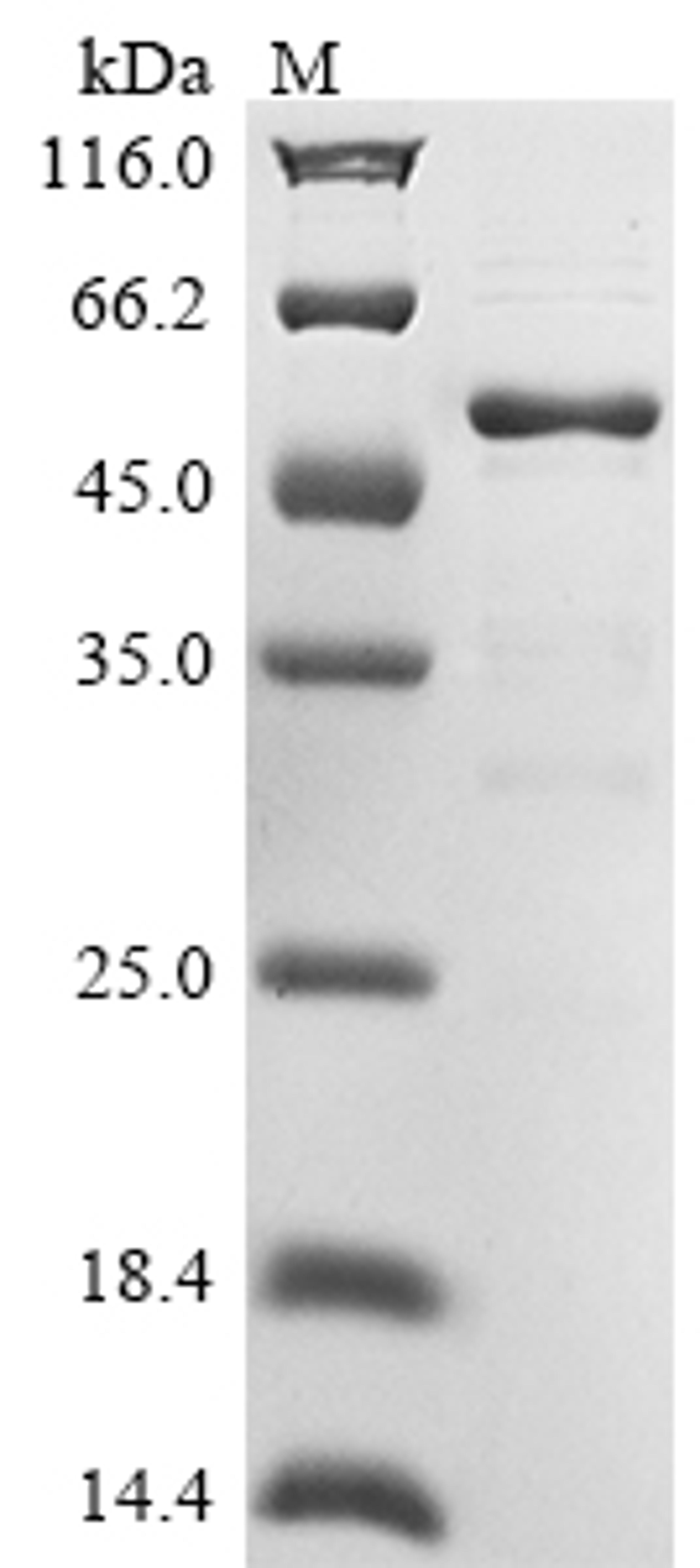 (Tris-Glycine gel) Discontinuous SDS-PAGE (reduced) with 5% enrichment gel and 15% separation gel.