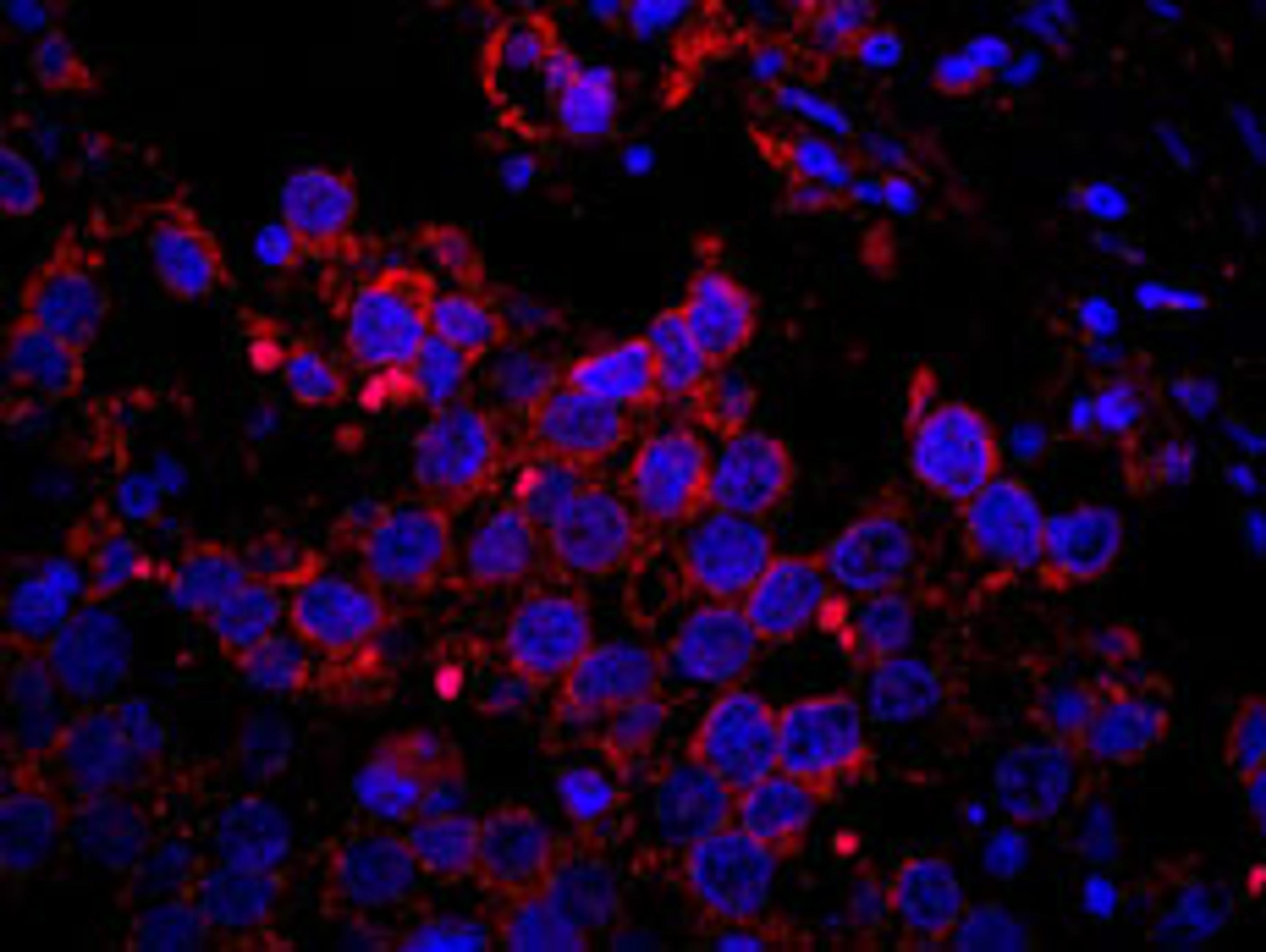 Detection of human IRS2 by immunohistochemistry.