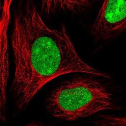 Immunocytochemistry/Immunofluorescence: Pepsinogen C/PGC/Progastricsin Antibody [NBP1-91011] - Staining of human cell line U-2 OS shows positivity in nucleus & nucleoli.