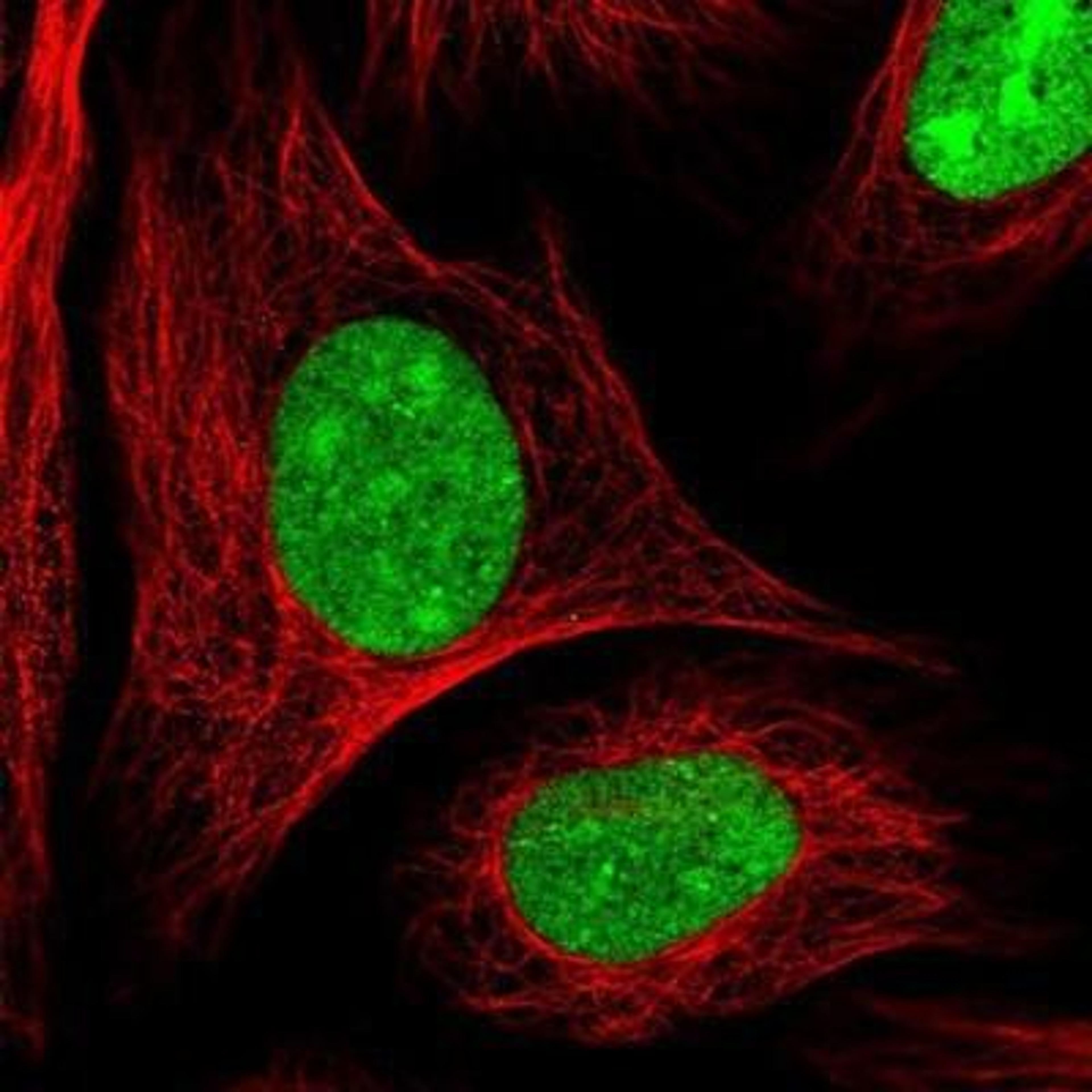 Immunocytochemistry/Immunofluorescence: Pepsinogen C/PGC/Progastricsin Antibody [NBP1-91011] - Staining of human cell line U-2 OS shows positivity in nucleus & nucleoli.